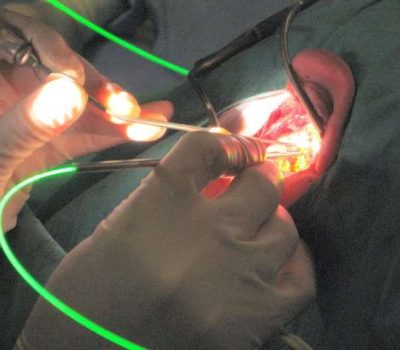 ktp-laser-ear-surgery-handsEvent Wifi Internet – LIVE SURGERY BROADCASTING SERVICE – ktp-laser-ear-surgery-hands LIVE SURGERY BROADCASTING SERVICE